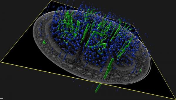 Aubergine observée en micro-tomographie aux rayons X avec segmentation des graines (en bleu) et des tissus vasculaires (en vert) © Marc Lartaud, Cirad