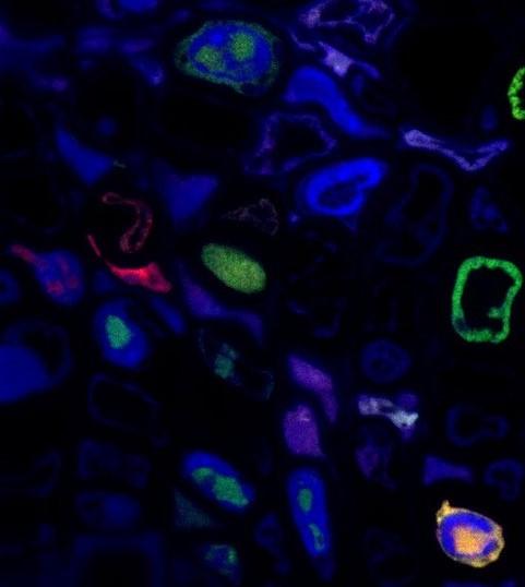 Imagerie par fluorescence montrant deux segments différents du génome du virus FBNSV localisés par hybridation in situ, l’un en vert et l’autre en rouge, dans des cellules différentes de la plante hôte. © S. Blanc, Inra