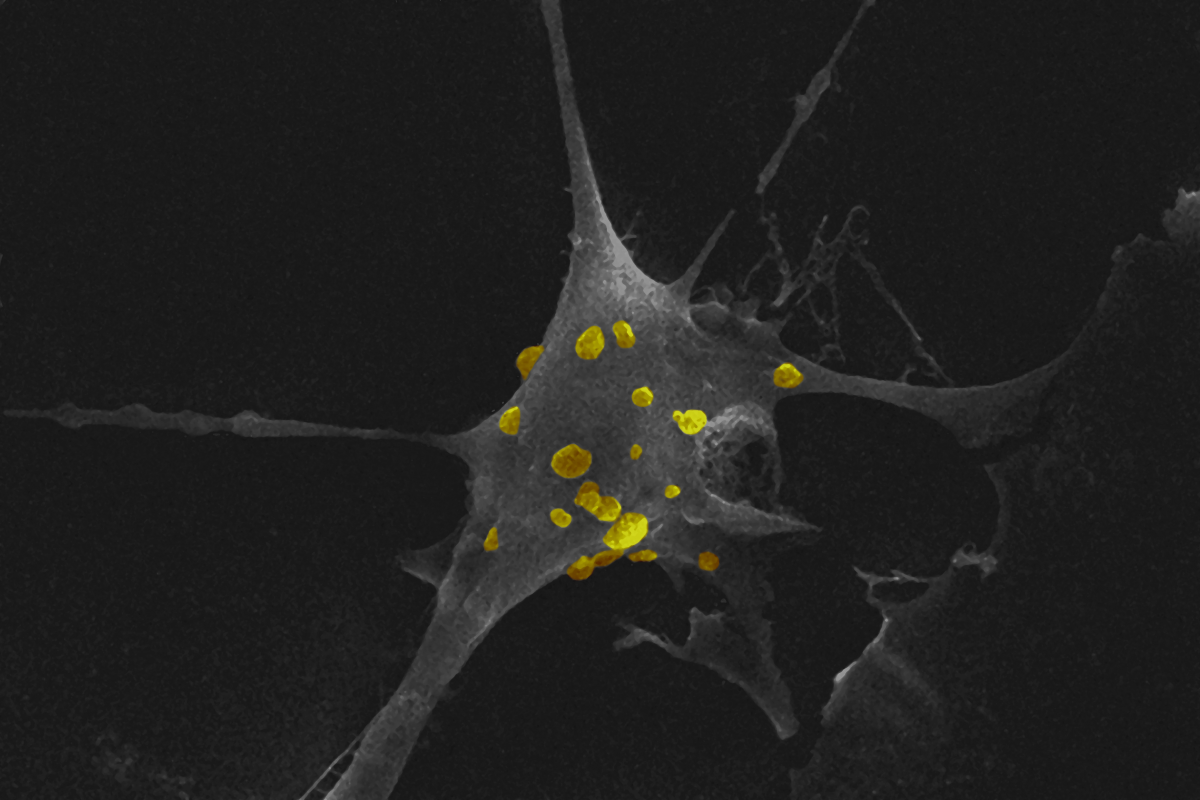 L'illustration montre en microscopie électronique à balayage (grossissement x20000), une phase précoce de la pathogénèse de la bactérie intracellulaire Ehrlichia ruminantium adhérant à sa cellule hôte (cellule aortique endothéliale bovine). © Cirad