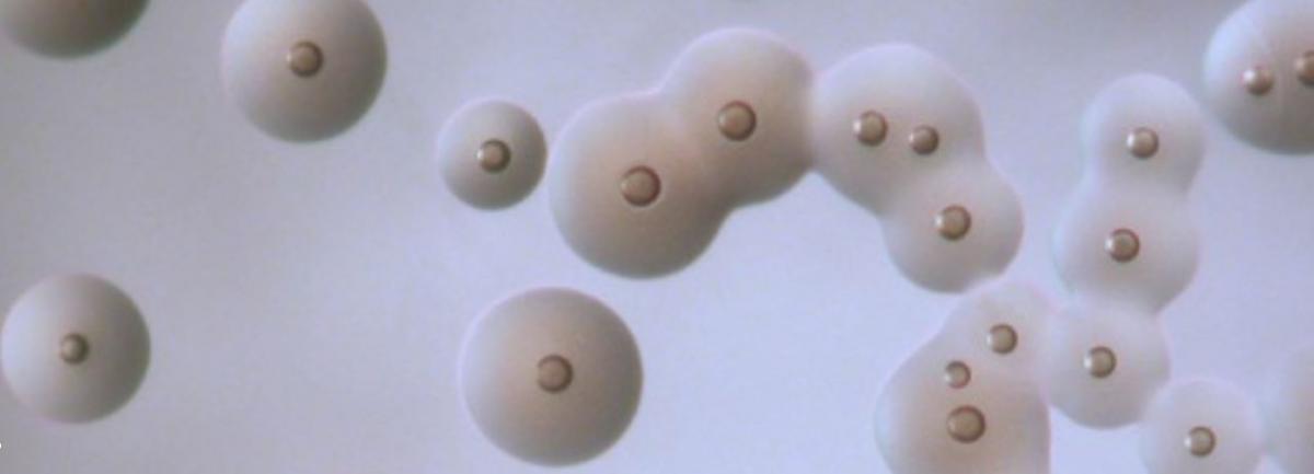 ELISA diagnostic kit to combat CBPP | Cirad